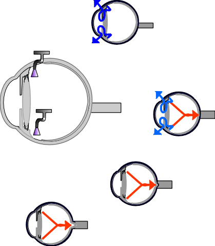 glaucomaflow.gif (24158 bytes)