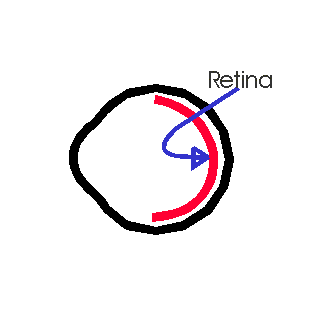maculopathy1098.gif (44985 bytes)